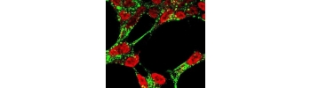 Dextran, Fluorescein labeled           Cat. No. DX3-FC-1     3000 Da    10 mg