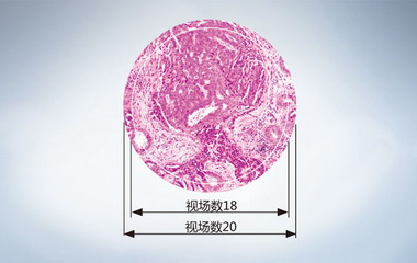 Olympus奥林巴斯进口生物显微镜CX23CX23